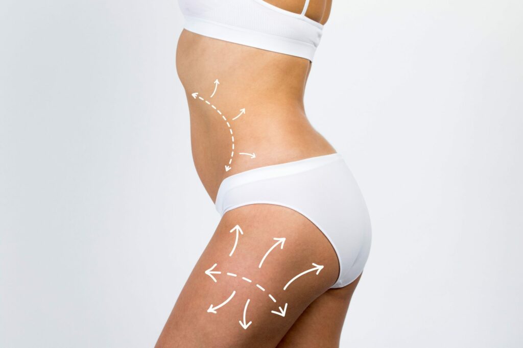 Non-surgical Breast/ Butt Lift treatment | Isya Aesthetics in Vasant Vihar, Delhi