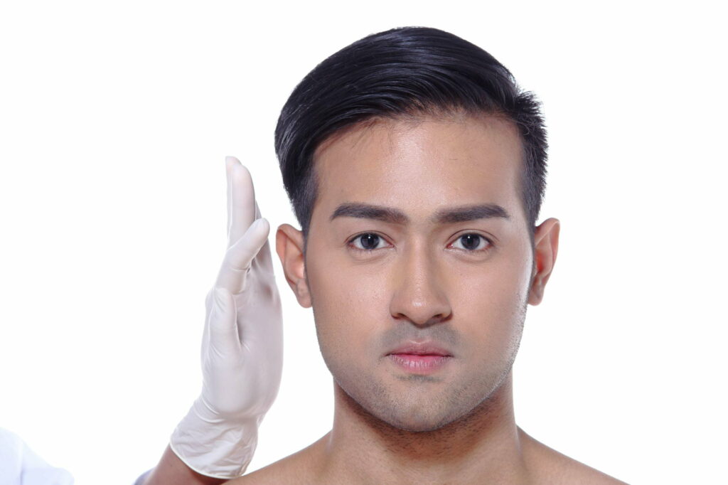 Man Face After Jawline Enhancement for Men Treatment | Isya Aesthetics | Vasant Vihar, New Delhi