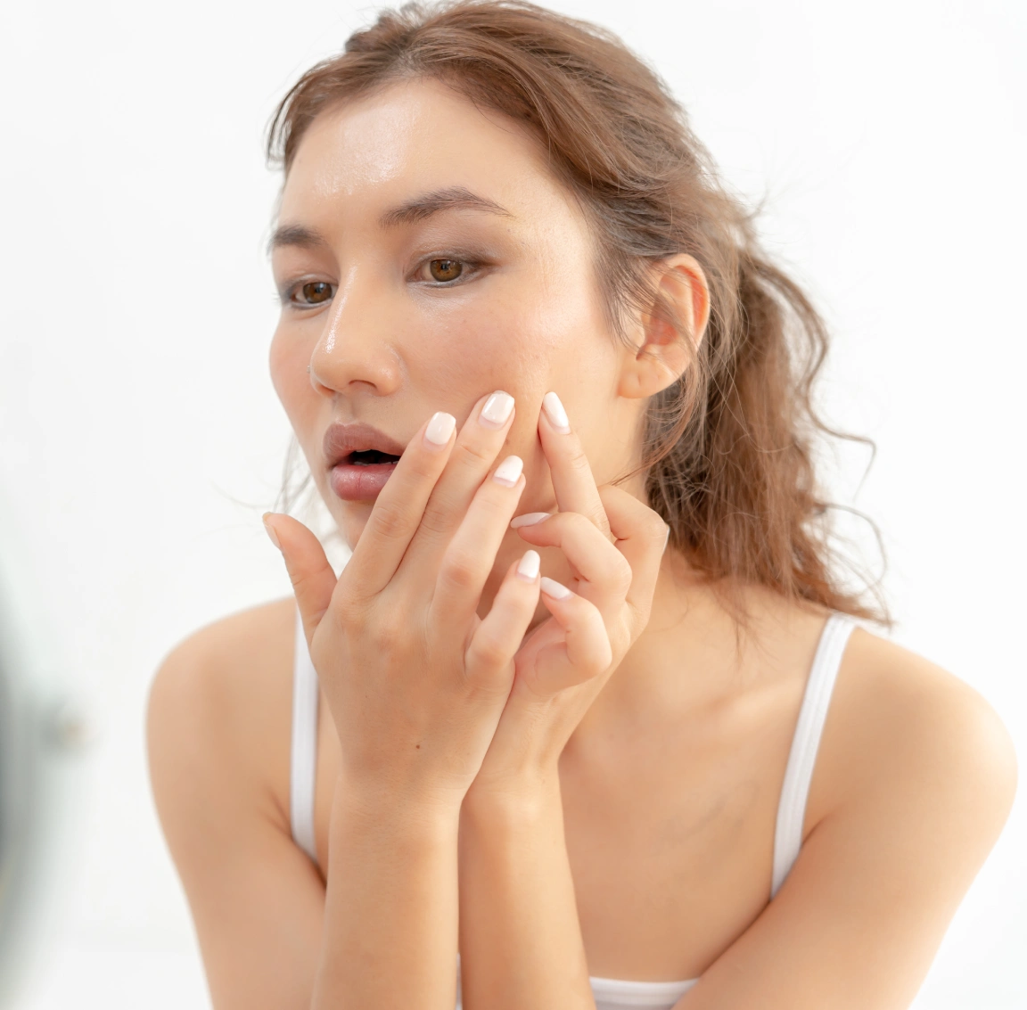 Best Acne Scars & Pimple Treatment In New Delhi