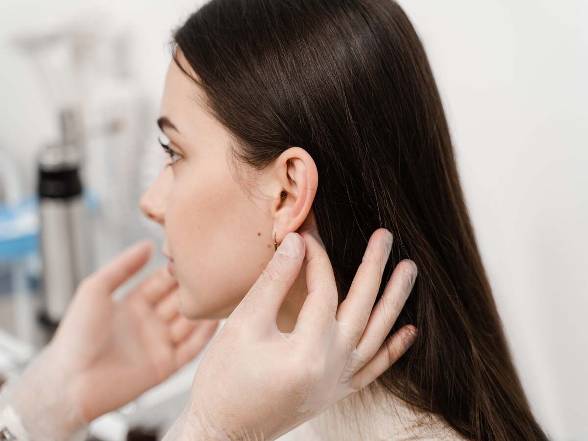 Medical Ear Piercing by Isya Aesthetics in Delhi