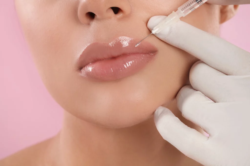 Lip Filler Longevity How Long Can You Enjoy Your Perfect Pout