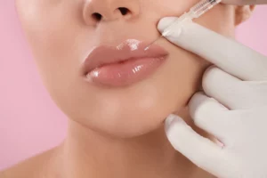 Lip Filler Longevity How Long Can You Enjoy Your Perfect Pout