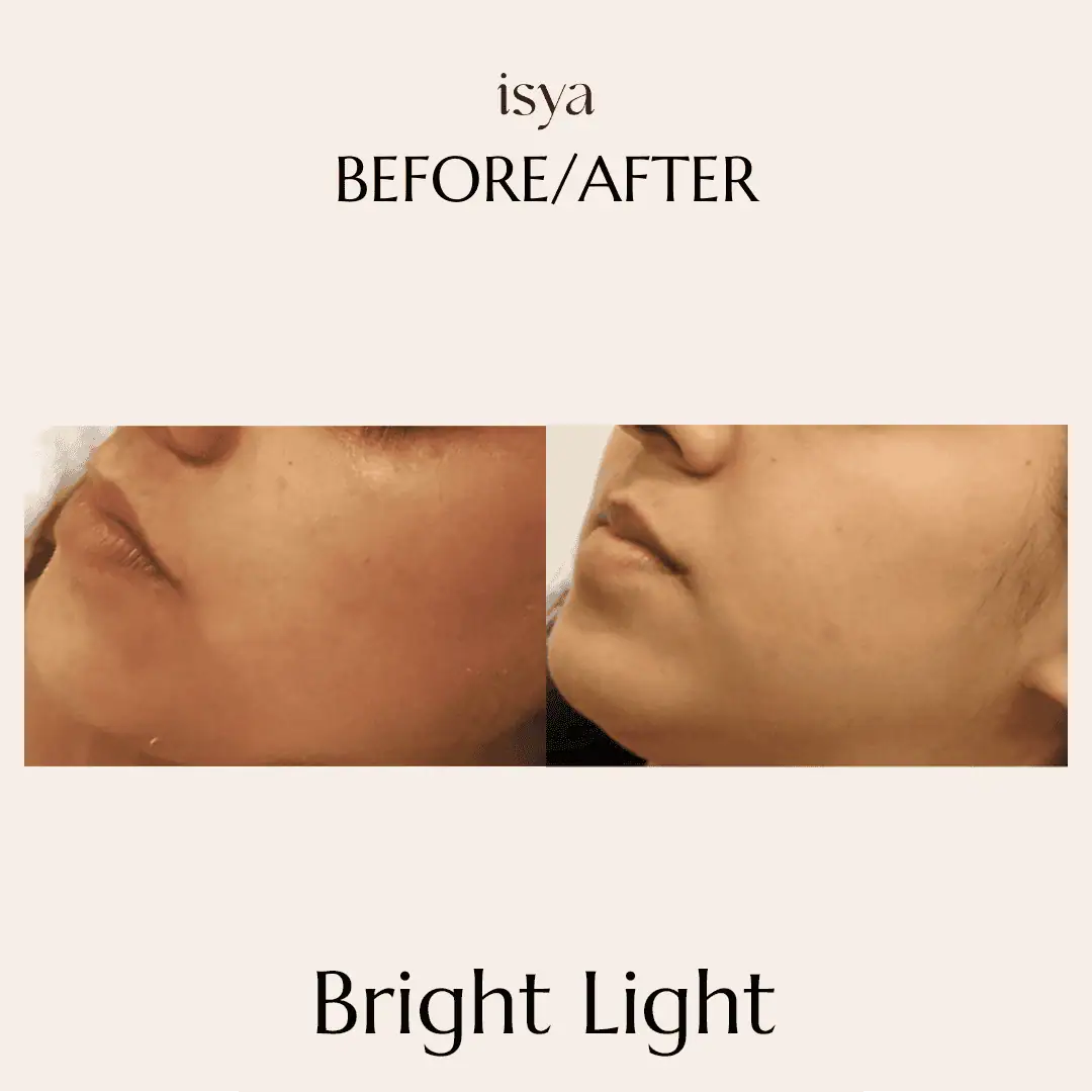 Bright Light Before & After 1