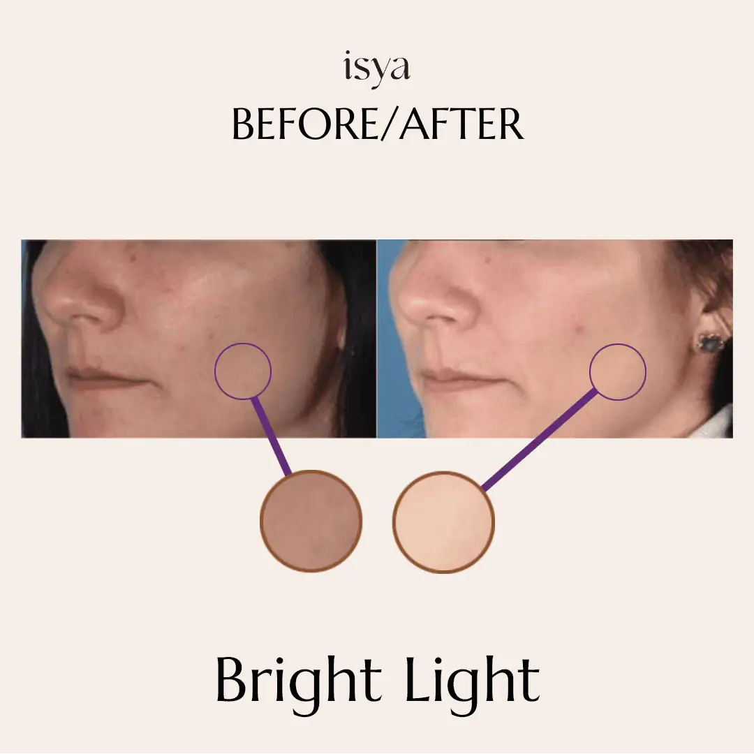 Bright Light Before & After 2