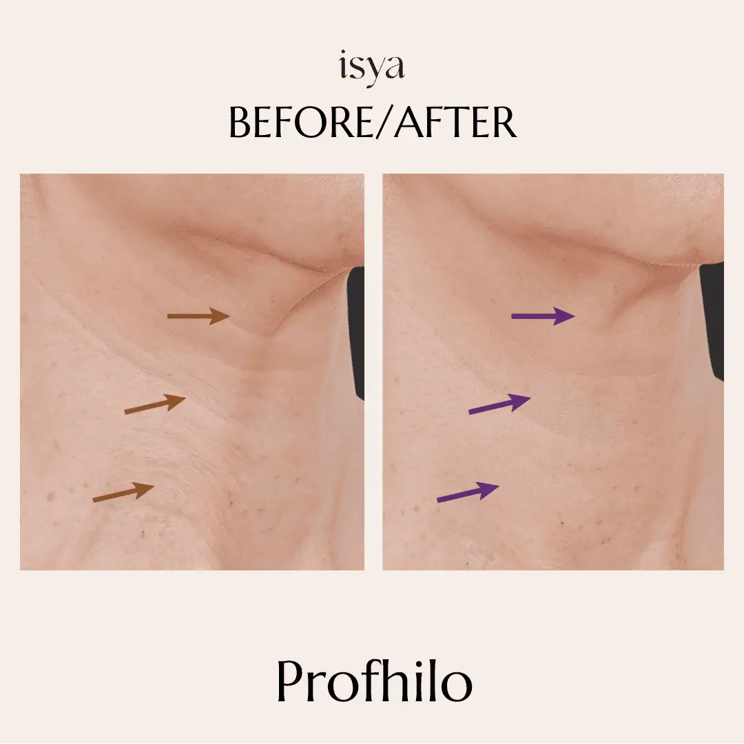 profilo1