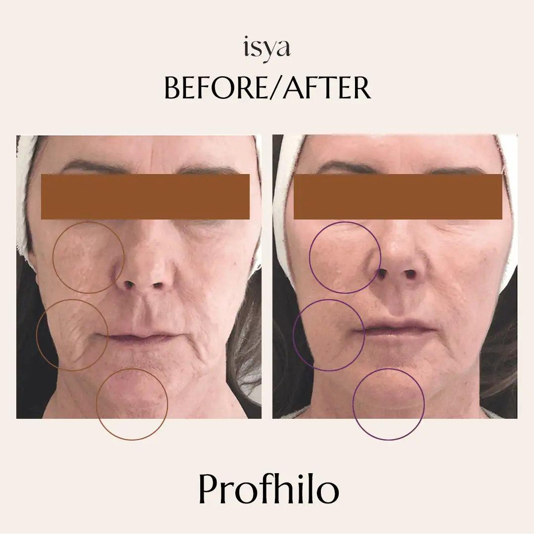 profilo2