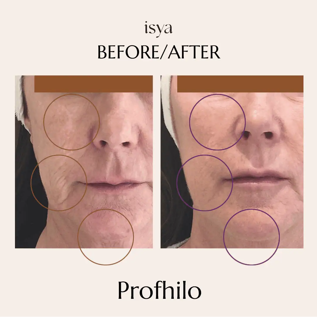 profilo3
