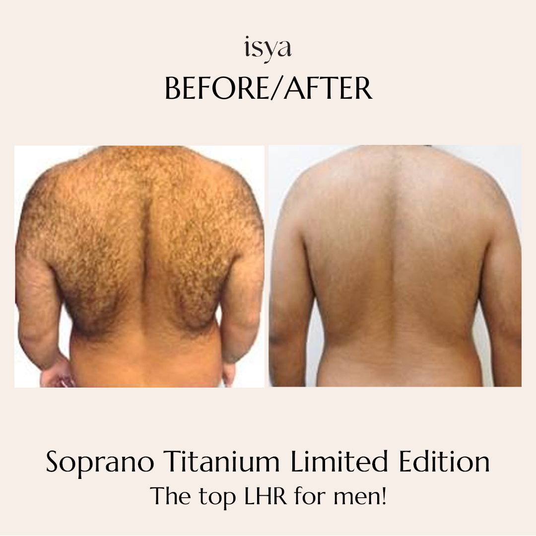 soprano titanium 2