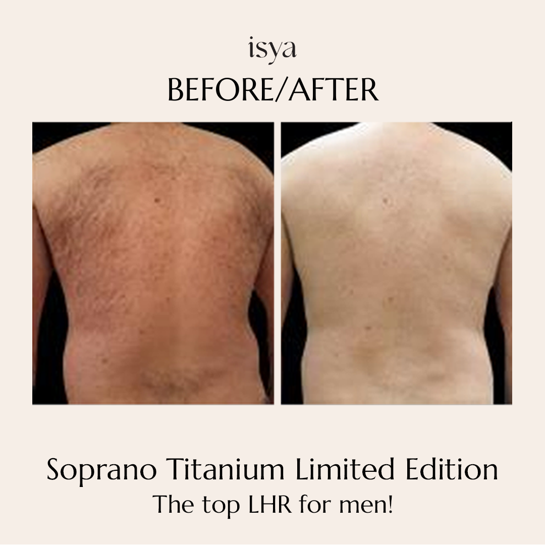 soprano titanium 3