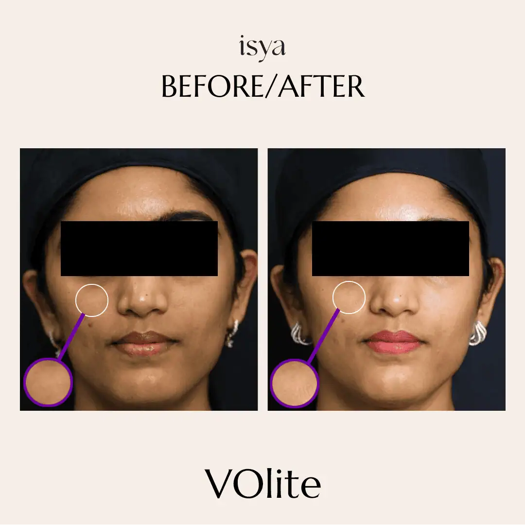 volite3