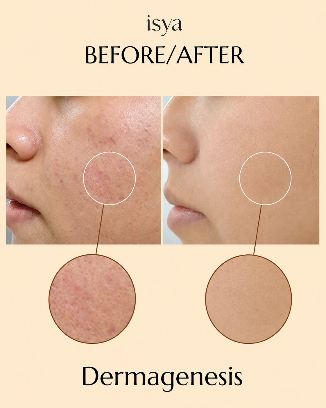 ISYA-Before-After-1