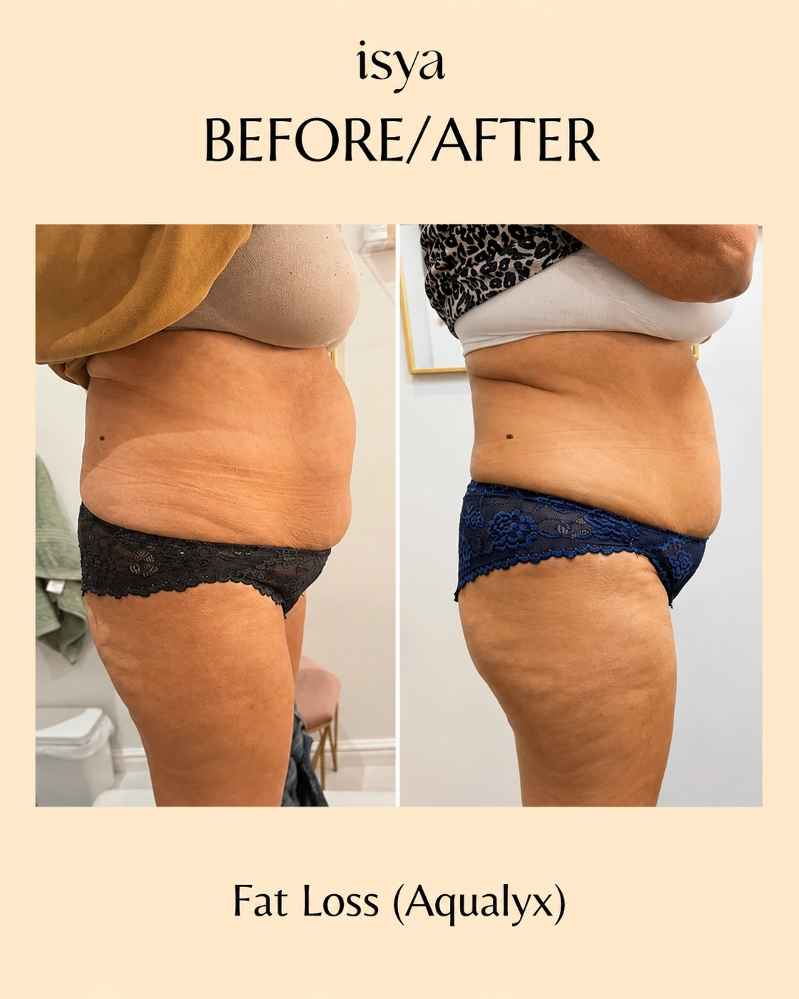 ISYA-Before-After-2