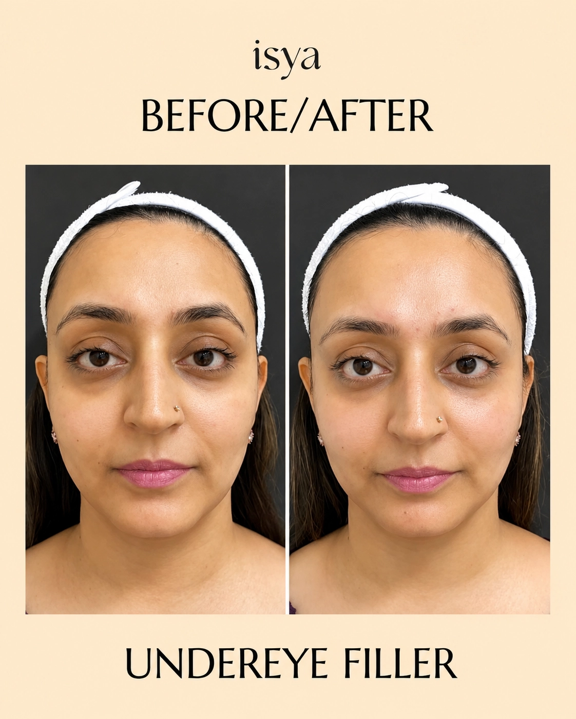 ISYA-Before-After-3-1