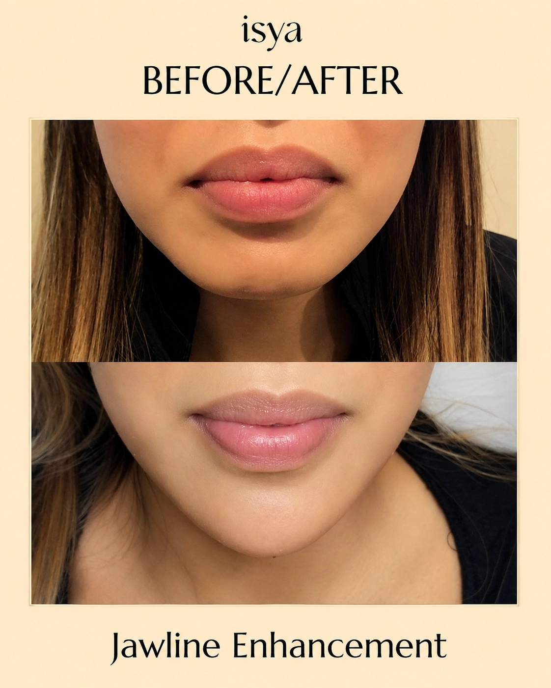 ISYA-Before-After