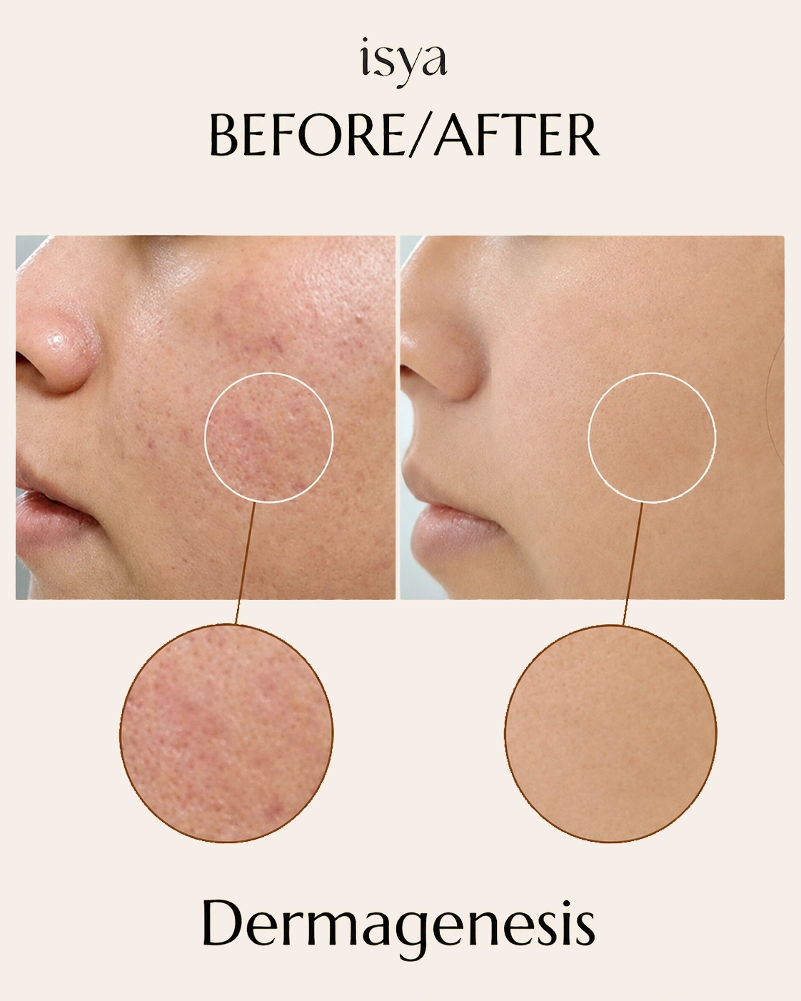 ISYA-Before-After-1