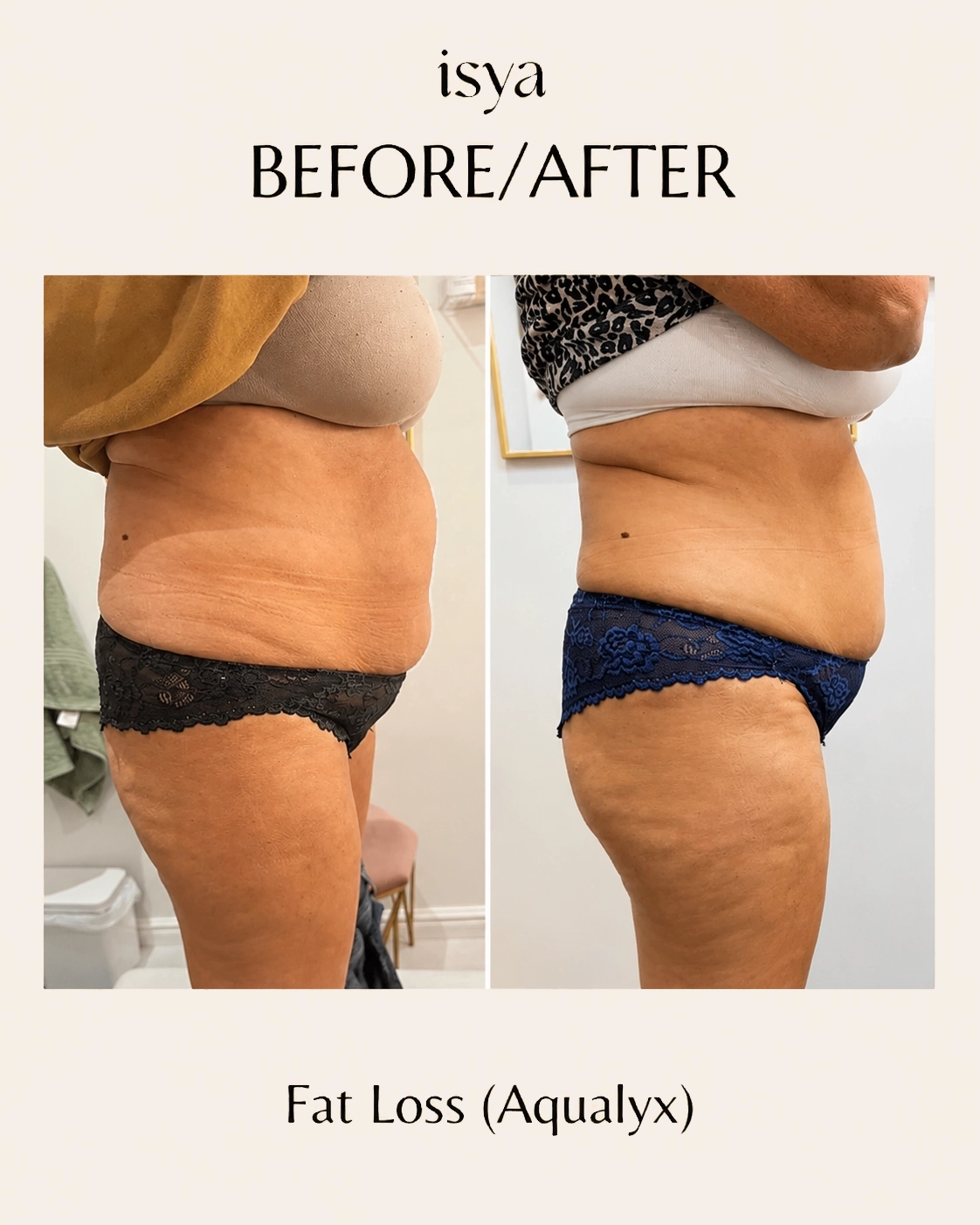 ISYA-Before-After-2