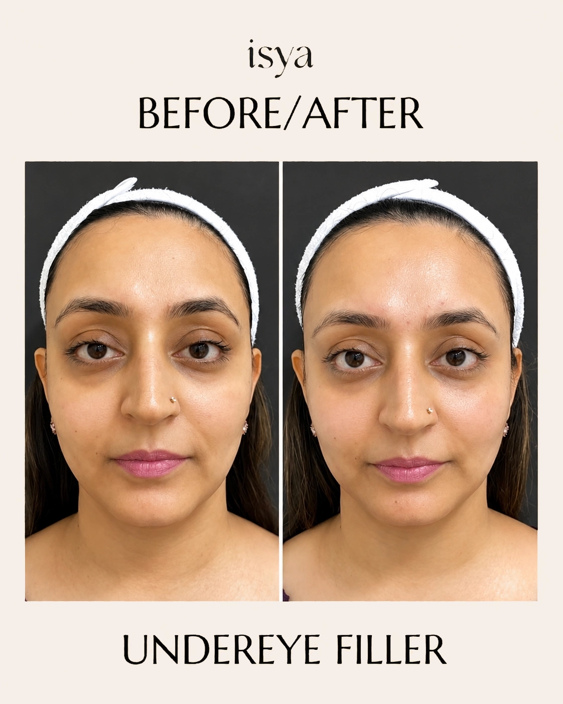 ISYA-Before-After-3-1