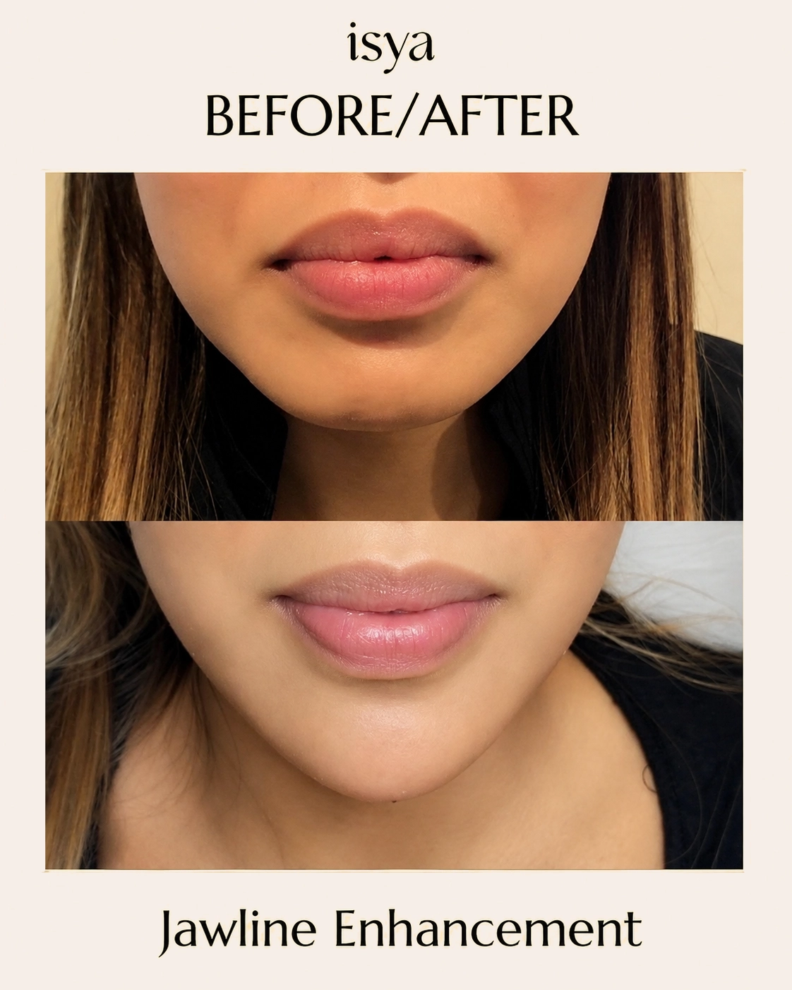 ISYA-Before-After